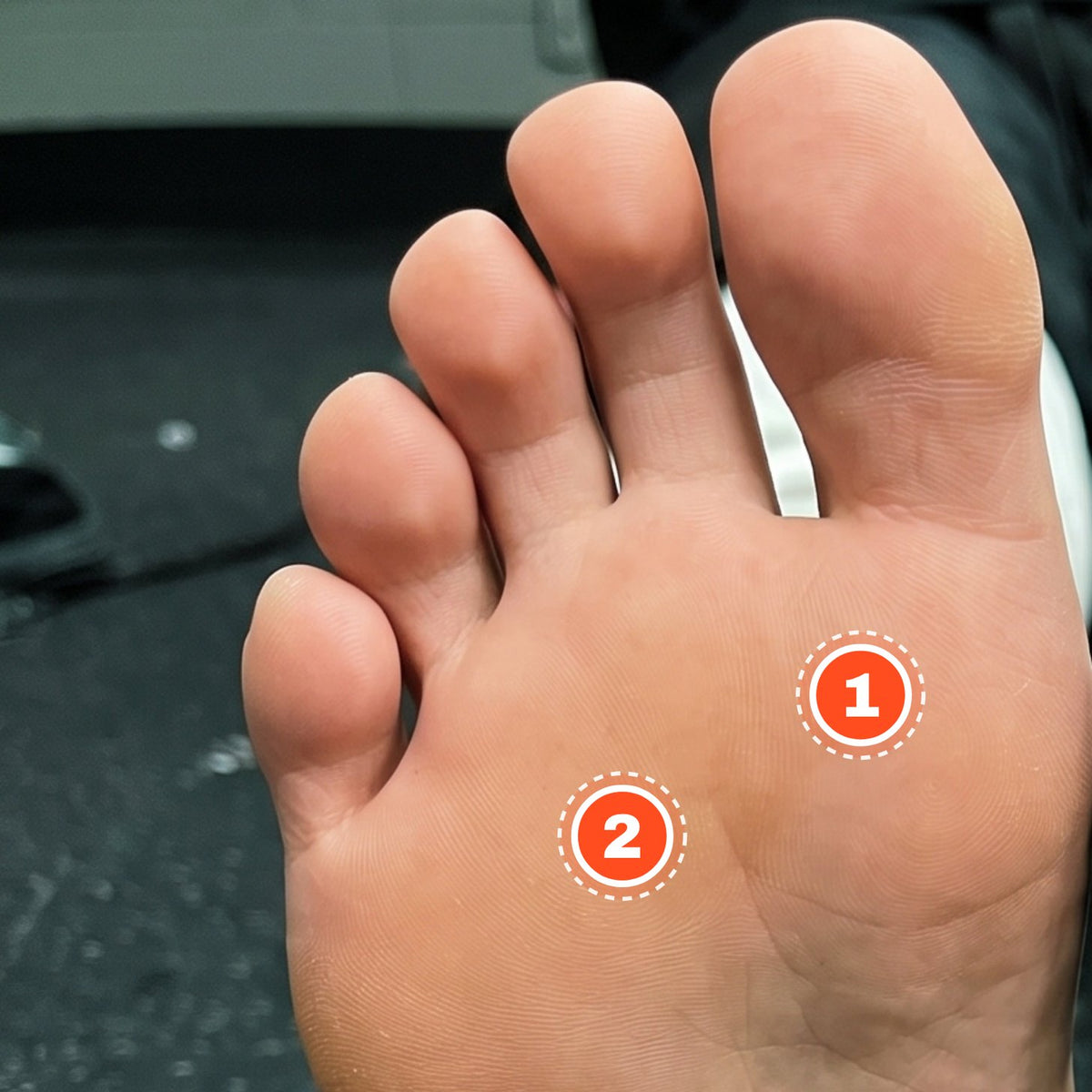 Sole of a bare foot with numbered markers on the big toe joint and the ball of the foot